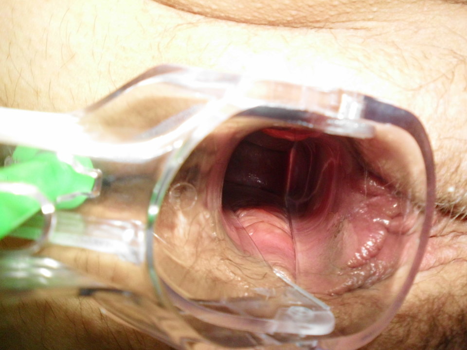 DSCI0421.JPG - lata70