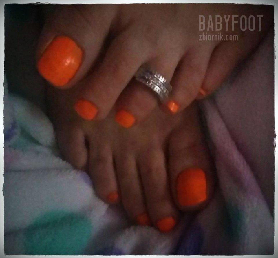 Słoneczne Pazurki - Babyfoot