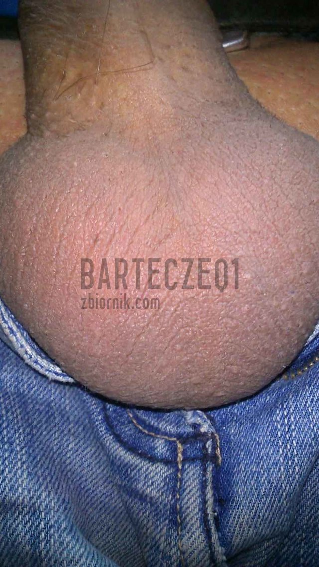 barteczeq1