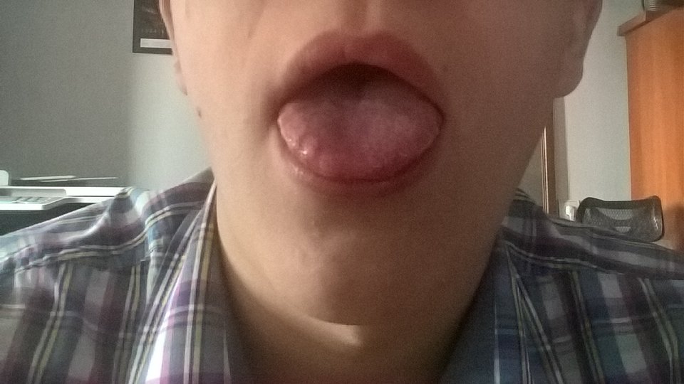 WP_20160628_15_25_05_Pro.jpg - slodkimlodziak