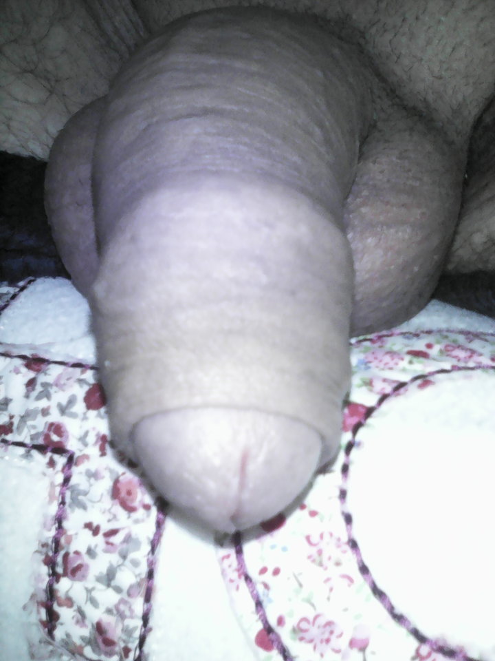 IMG_20160828_080420.jpg - malzonko