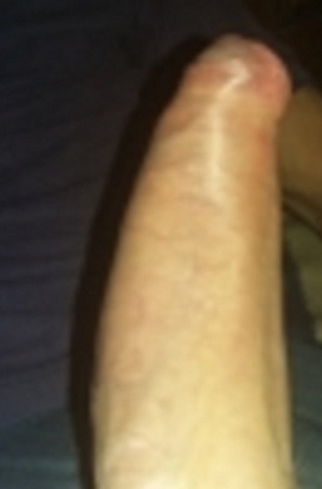 dlug12