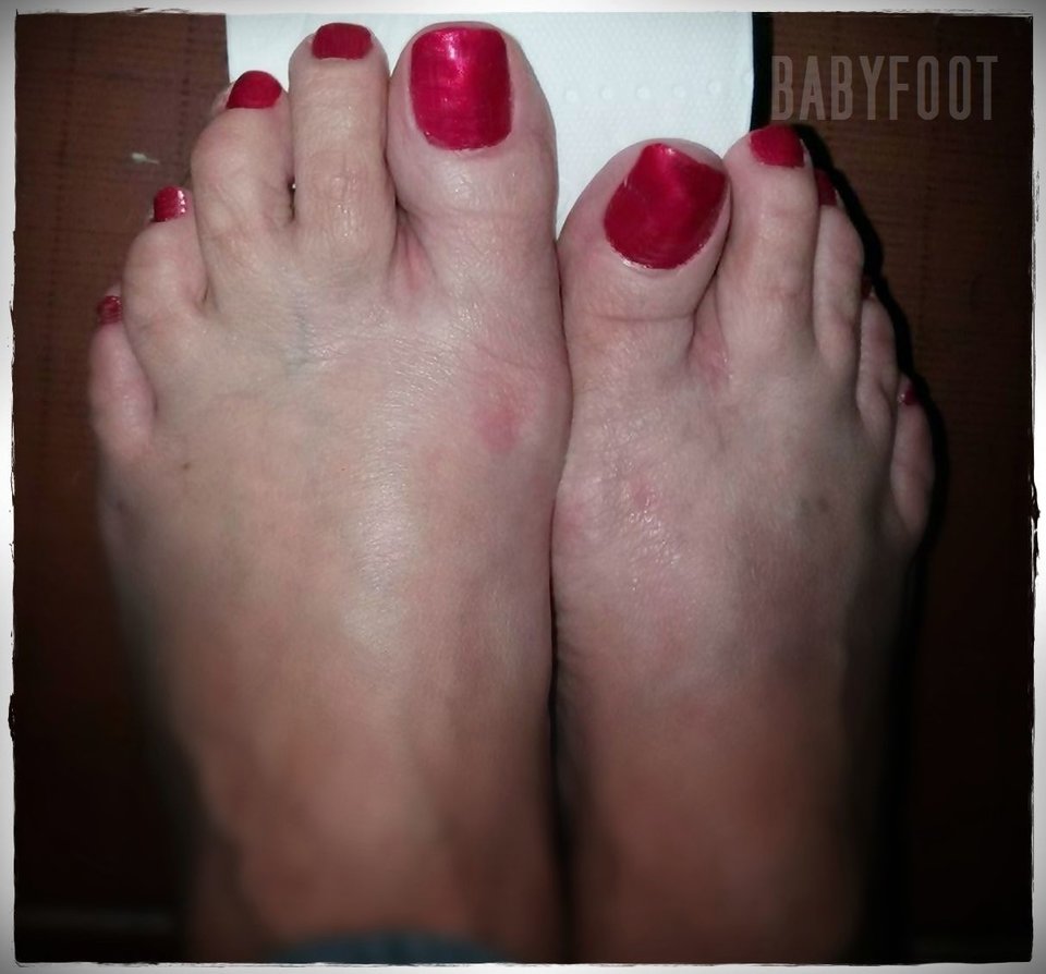 czerwone lizaczki - Babyfoot