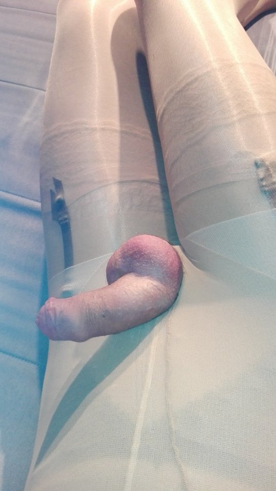 IMG_20170324_163958.jpg - Encased1916