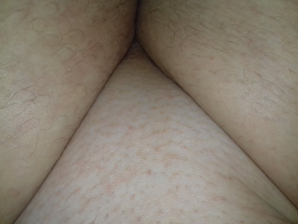 20170415_092652.jpg - robercu