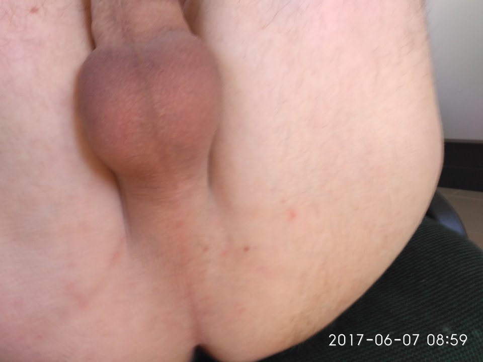 IMG_20170607_085955.jpg - dyskrecjazapewniona