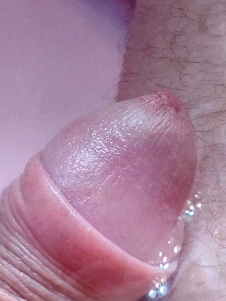 IMG_20170708_061526.jpg - matuzalem000