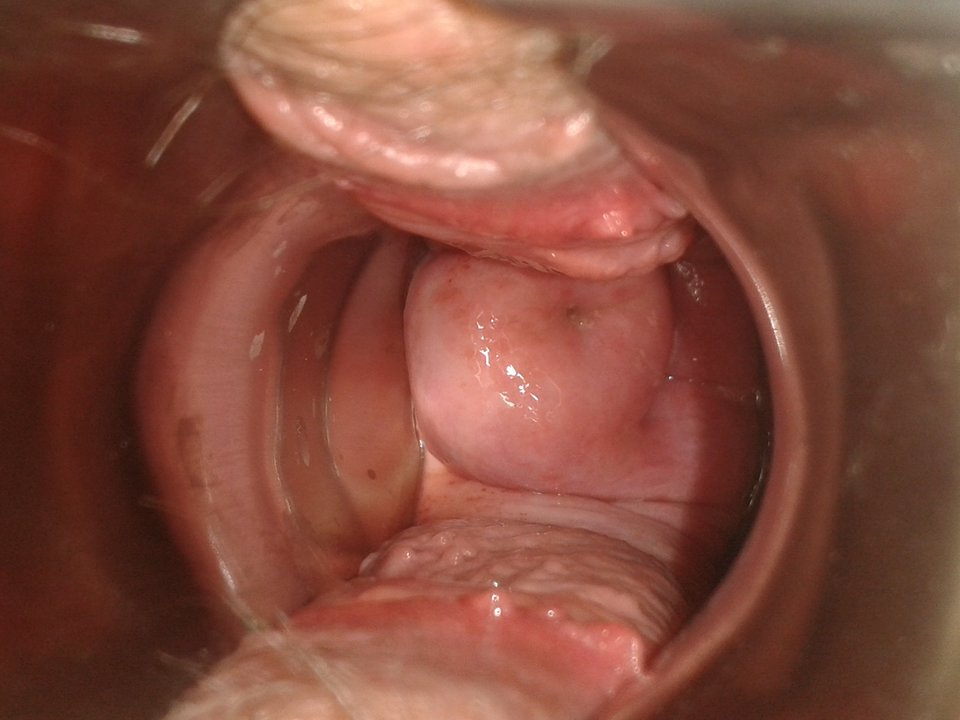 20170708_232225.jpg - lata70