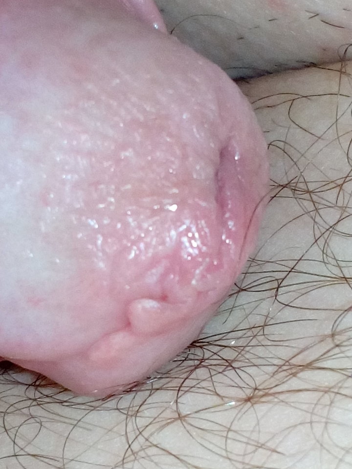 IMG_20170805_072922.jpg - matuzalem000