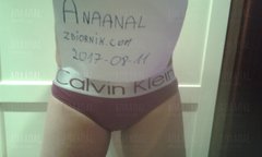 20170811_103613.jpg