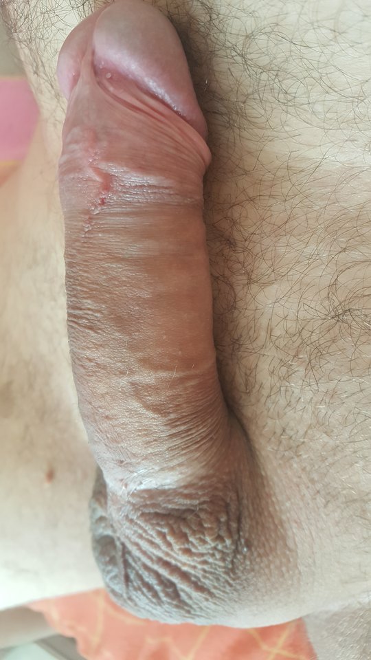 20170911_105058.jpg - perwers42