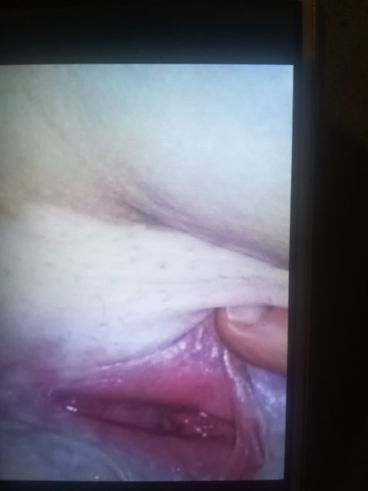 IMG_20171018_201732.jpg - asdfghjklk