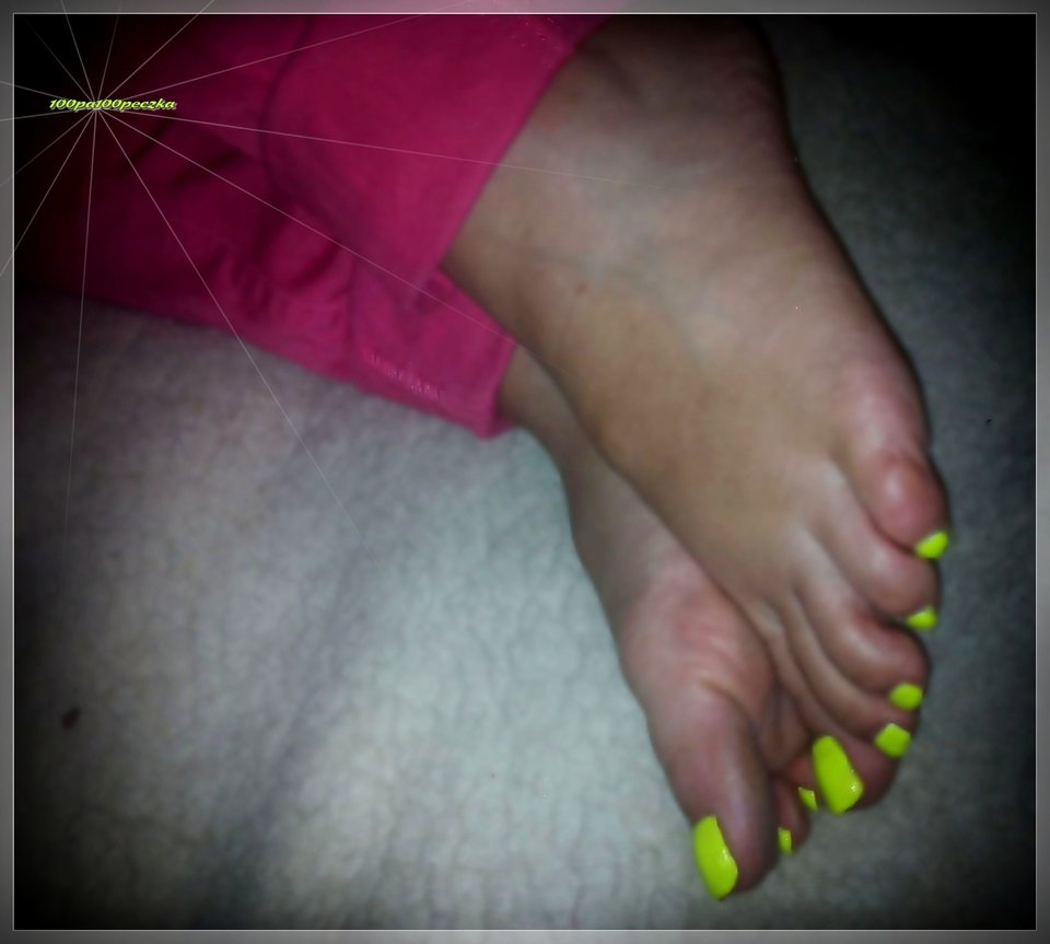 Neon Yellow #62 - 100pa100peczka