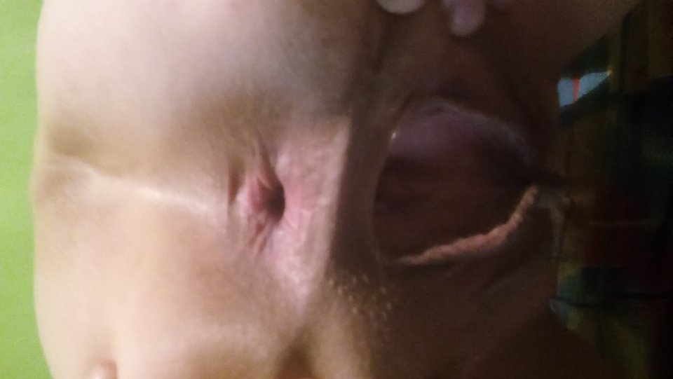 20171101_223540.jpg - MyToma