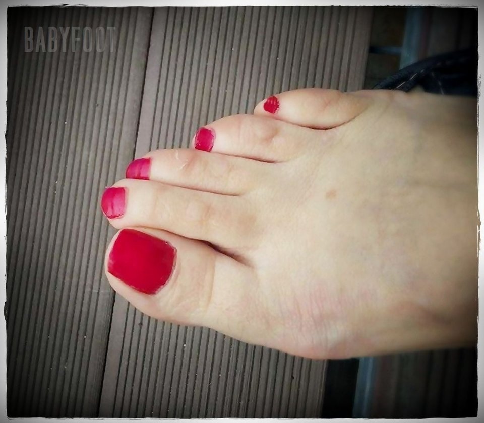 czerwone landrynki - Babyfoot