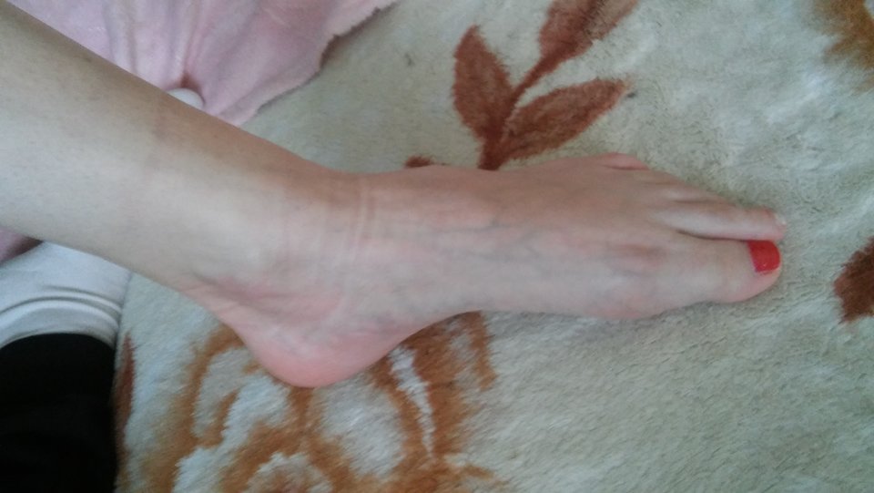 20180128_101456.jpg - Parka3031