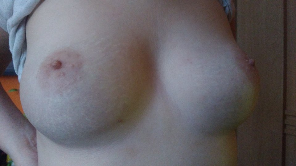 P_20180216_072720[1].jpg - parka_8180