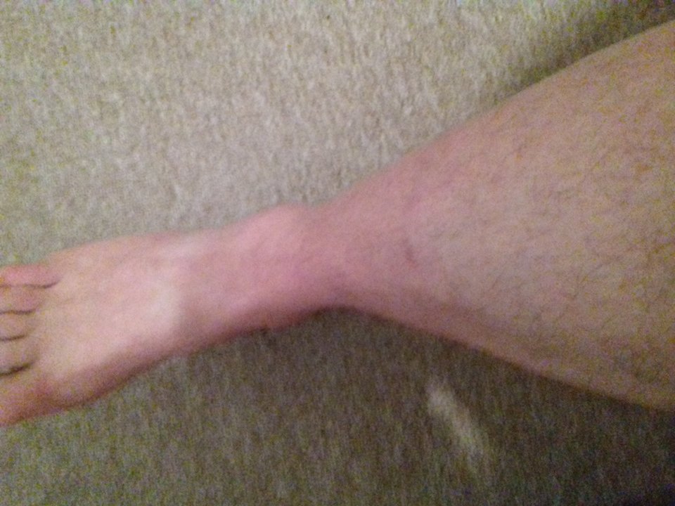 20180503_080724.jpg - velur11