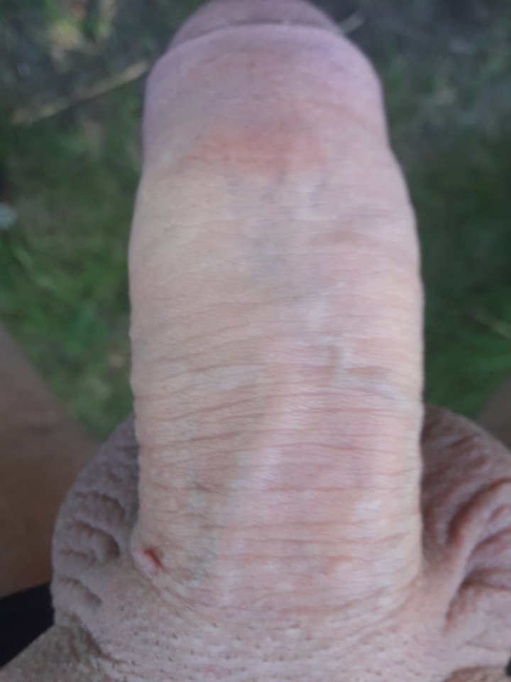 20180529_112622.jpg - acert5742