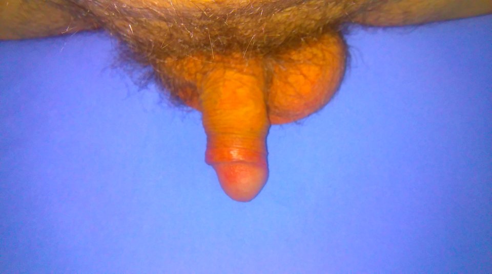 IMAG1813.jpg - onilubiacyto