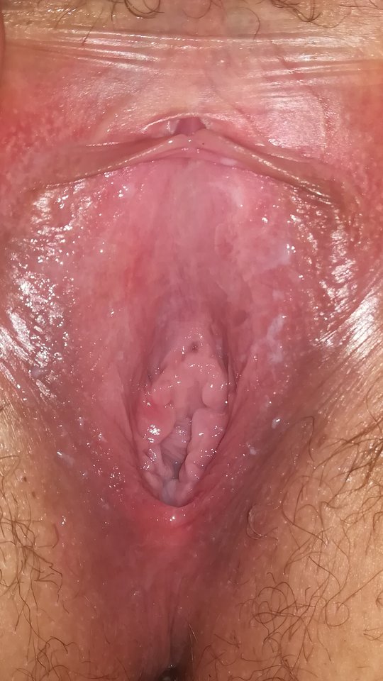 IMG_20180612_100846.jpg - orgia24h2