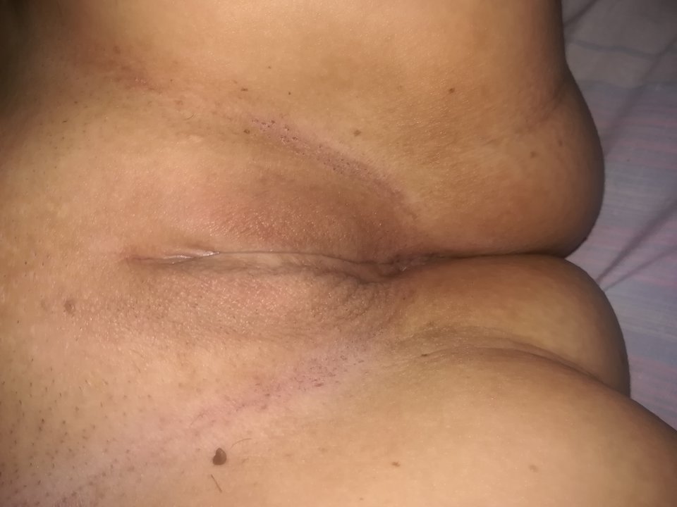 IMG_20180613_070752.jpg - orgia24h2