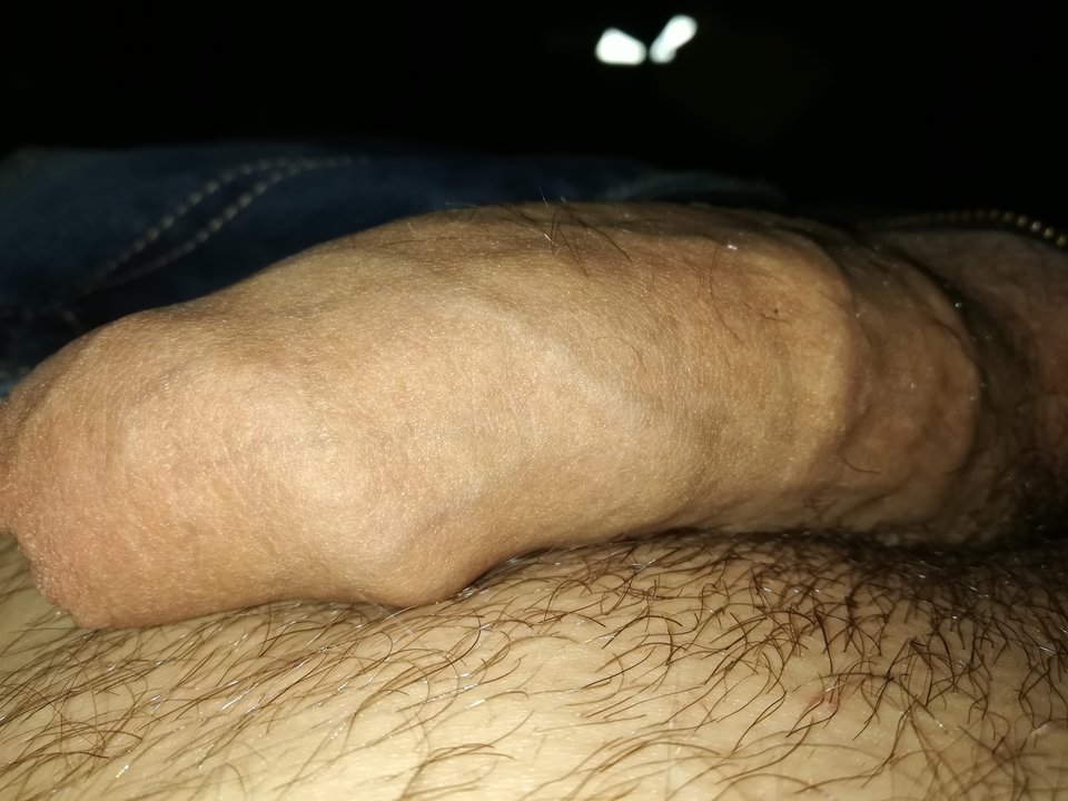 IMG_20180613_195149.jpg - incognitoooo