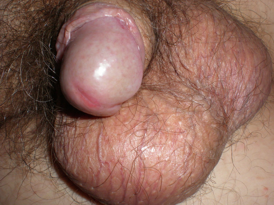 P1010095.JPG - Radar35