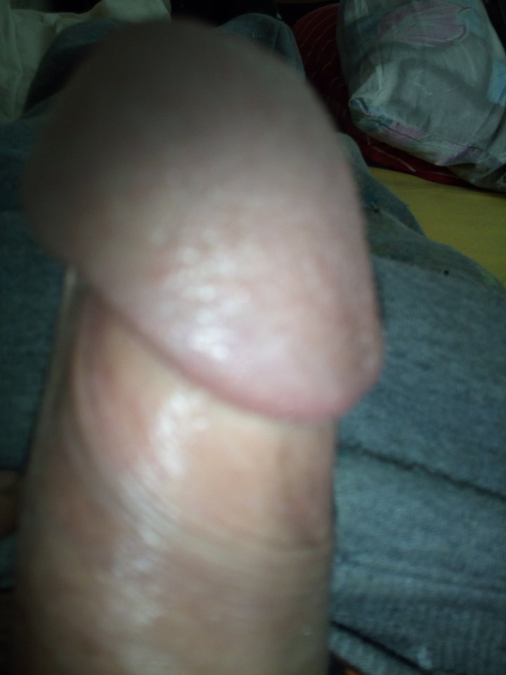 IMG_20180824_110243.jpg - Mrowka72