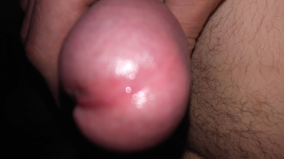 20180923_045812.jpg - psule