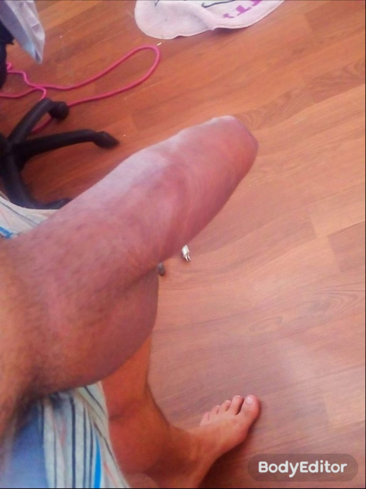 BodyEditor_20181202_095448527.jpg - SamotnySzuka1986