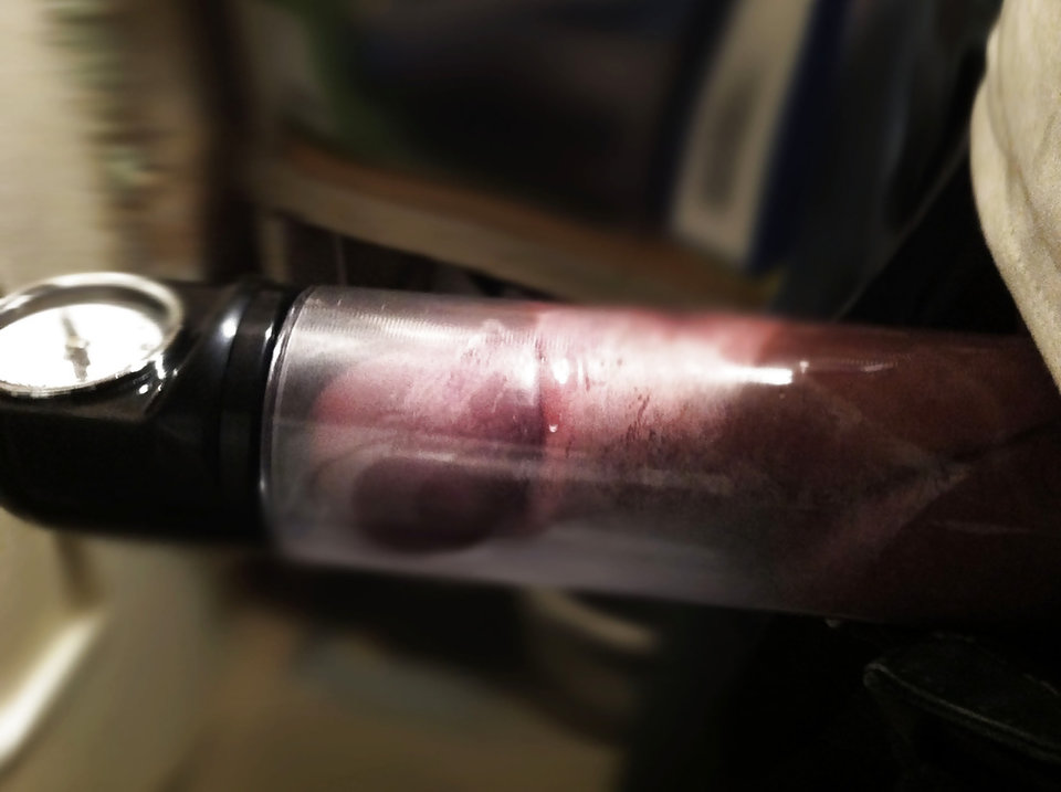 277_1000.jpg - RATCVAC