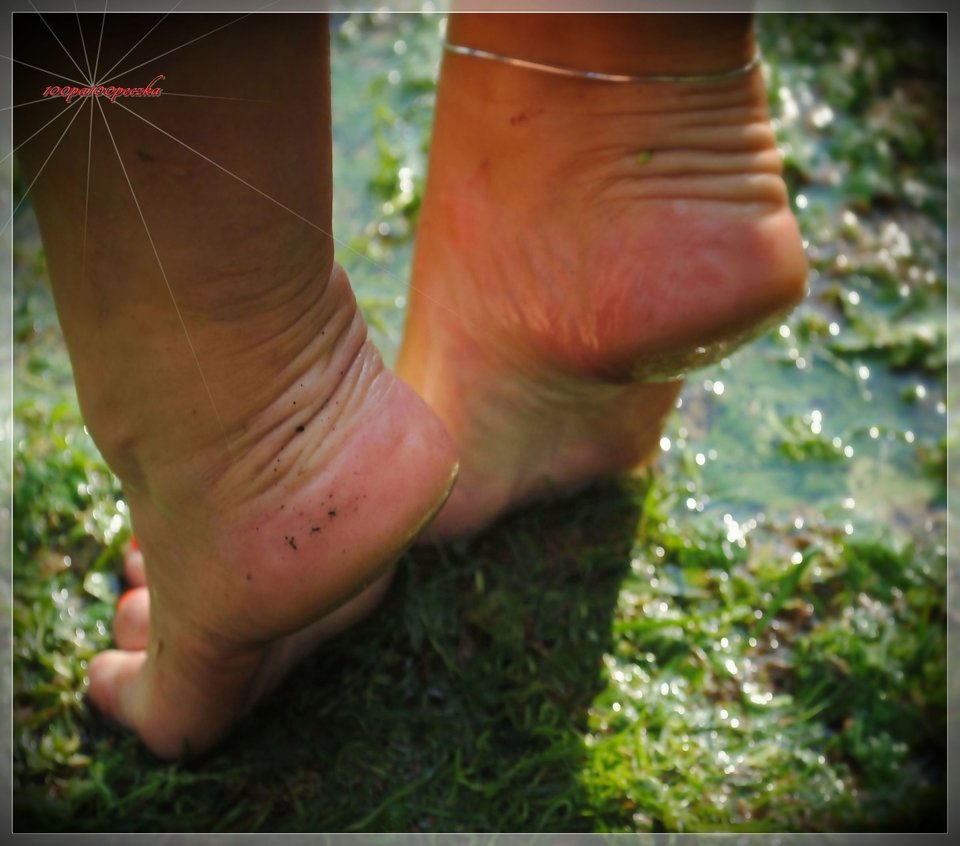 Piętki#303 - 100pa100peczka