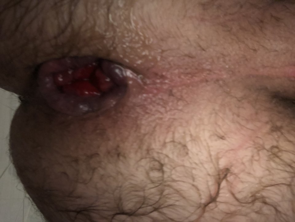AACFDC4E-1F65-4590-A302-2F34EF671AD4.jpeg - rafal1410