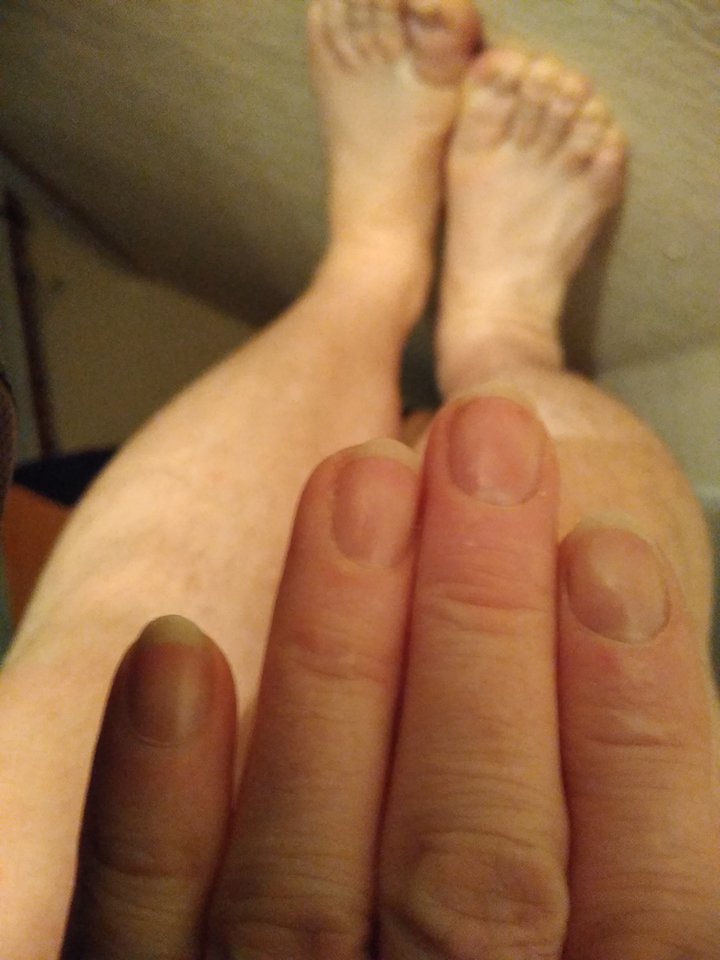 15820621265264528996169402306309.jpg - Palciusia