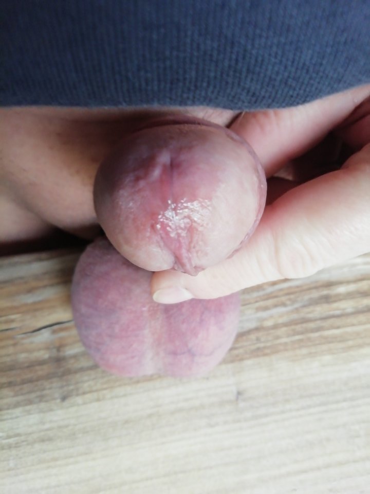 IMG_20200222_092229.jpg - wirus101