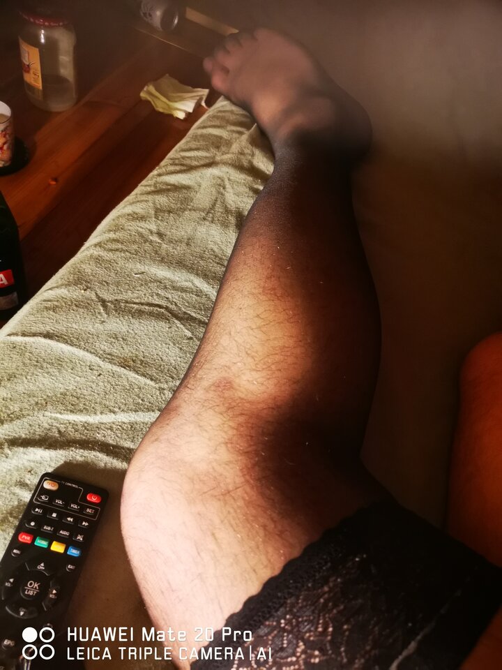 IMG_20260324_215445.jpg - Dyziole