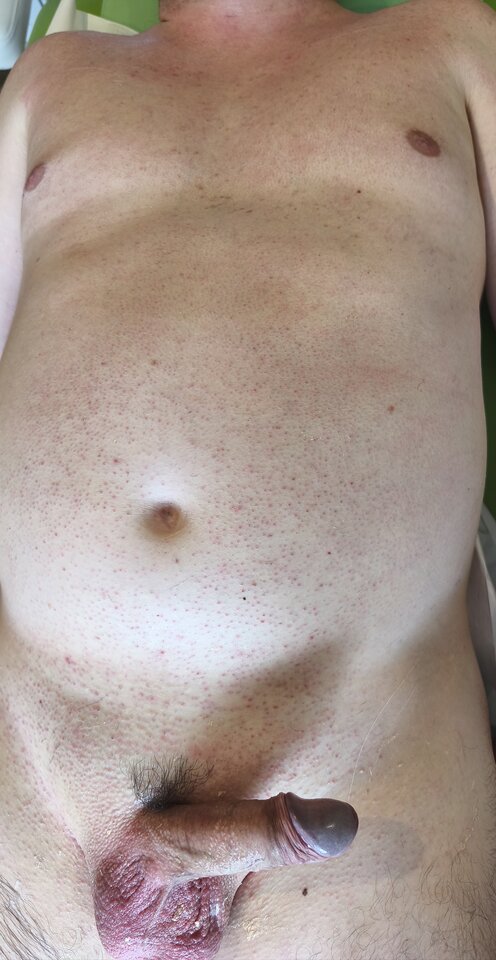 Po depilacji  - Zwyklioni