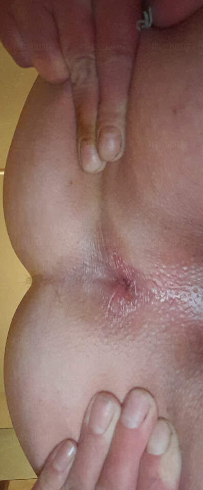 Analna dziurka 2026 1000026489.jpg - para2230waw