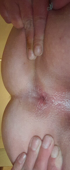 Analna dziurka 2026 1000026489.jpg