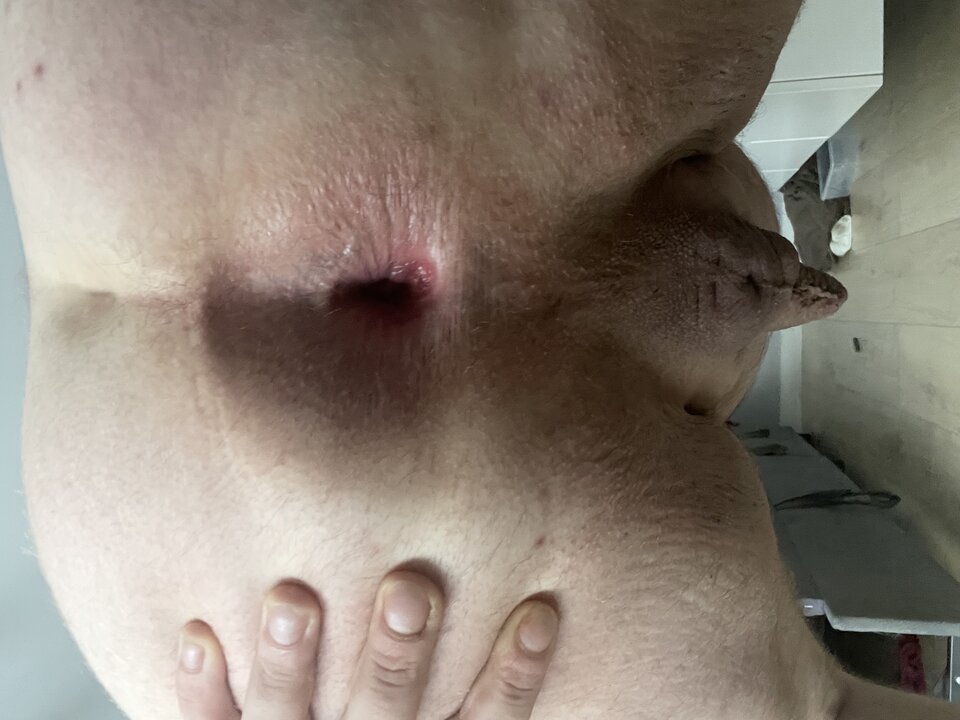 IMG_0328.jpeg - obciagnestarszemu