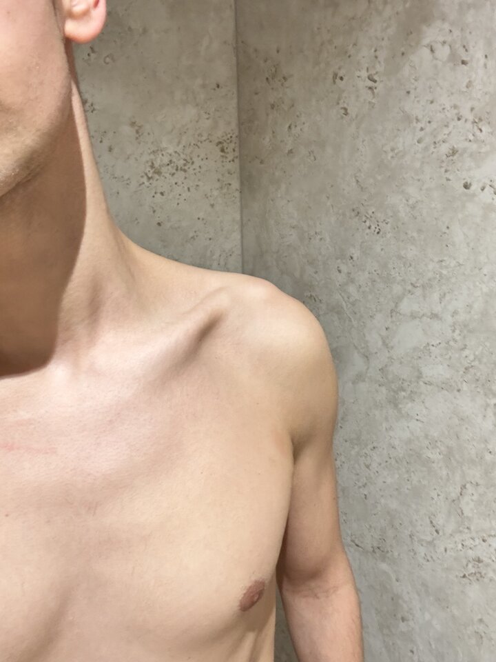 IMG_9828.jpeg - F4jlip