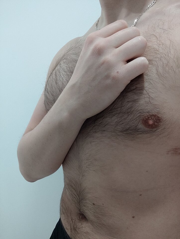 1000040539.jpg - 6Kutanoid9