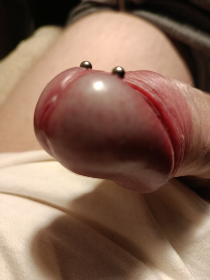 1000011630.jpg - glaukos_