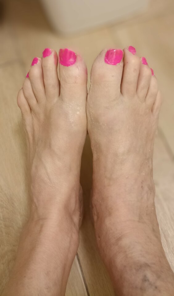 1000017740.jpg - haaggridd