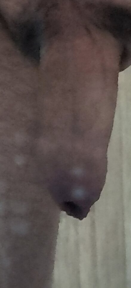 1000047313.jpg - Parkka321